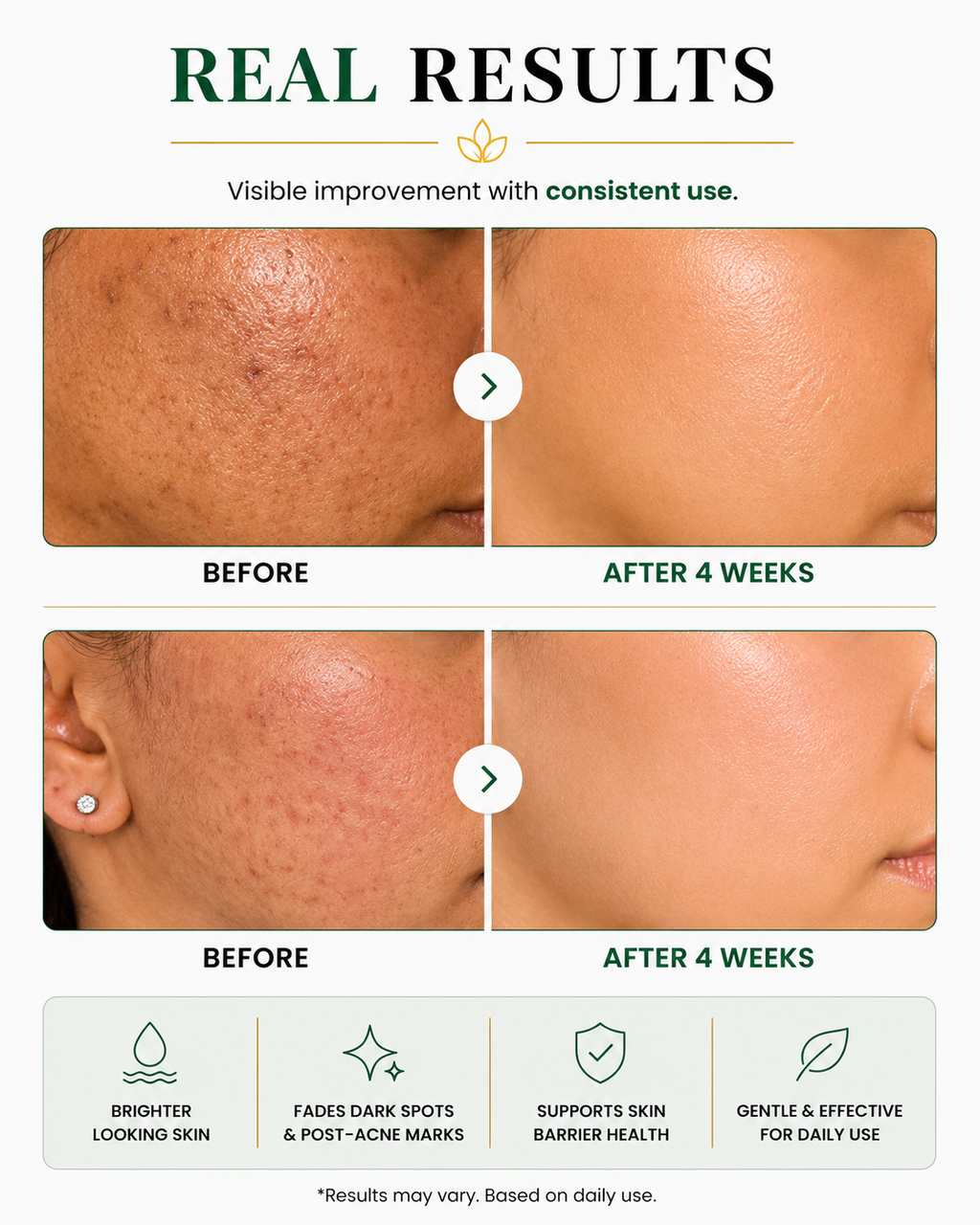 AXIS-Y Dark Spot Correcting Glow Duo – Complete Brightening & Hydration Set