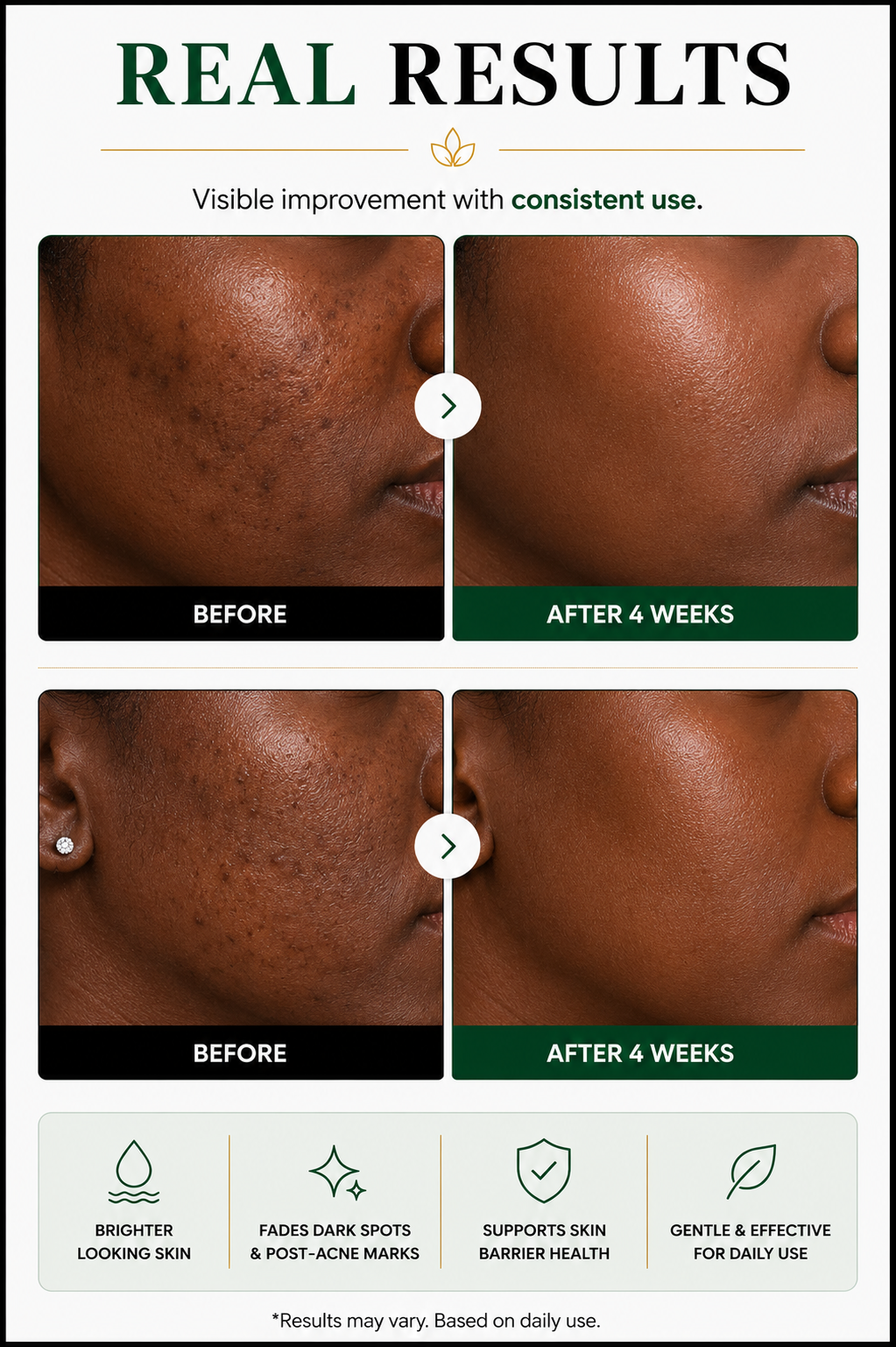 AXIS-Y Dark Spot Correcting Glow Duo – Complete Brightening & Hydration Set